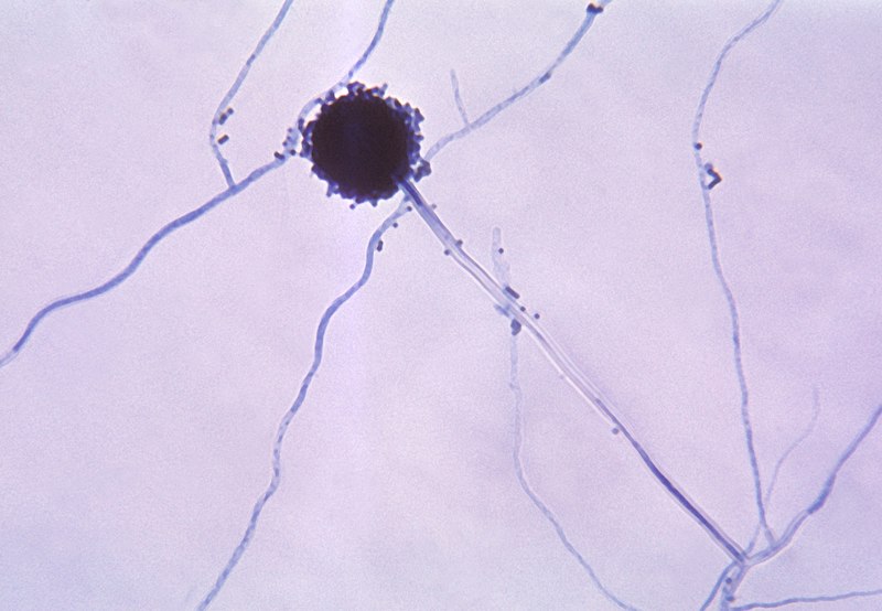 File:Aspergillus niger 01.jpg