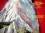 Flexor pollicis brevis muscle