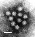 El Virus de Norwalk (Calicivirus) a menudo es causa de gastroenteritis en cruceros y hospitales.