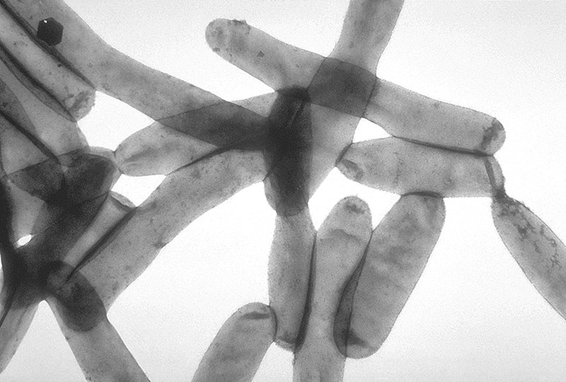 Файл:Legionella pneumophila 01.jpg