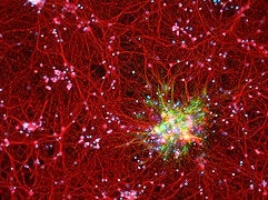 The Galaxy Within, a 10x image of cultured mouse cortical neurons and astrocytes in cell culture, by Dustin Johnsen