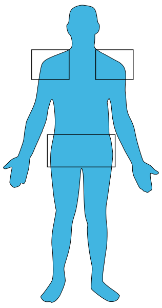 File:Polymyalgia rheumatica man.svg