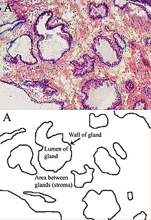 Prostatehistology.jpg