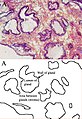 Prostate under a microscope This image shows the microscopic glands of the prostate