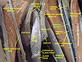 Femoral artery