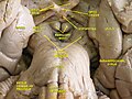 Cerebrum.Inferior view.Deep dissection.