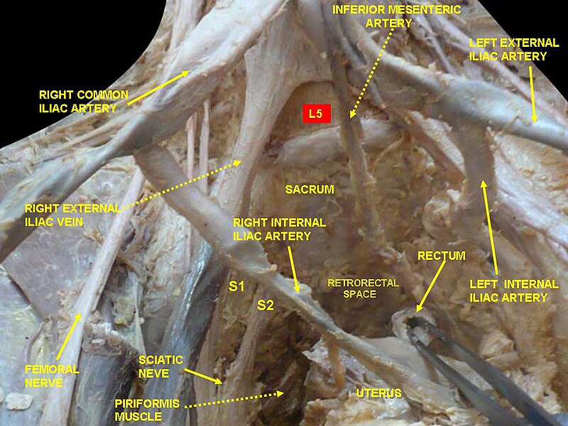 File:Slide1ewew.JPG