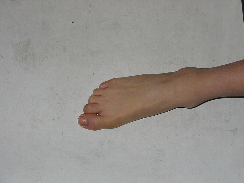 File:Foot.jpg