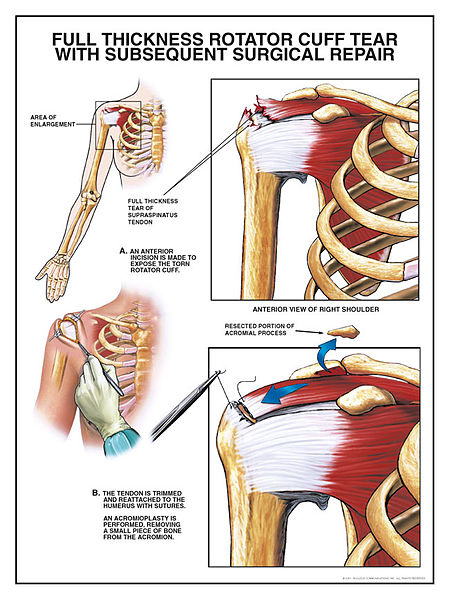 File:Rotator cuff high.jpg