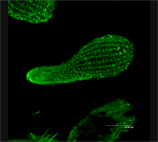 Файл:Tetrachimena Beta Tubulin.png