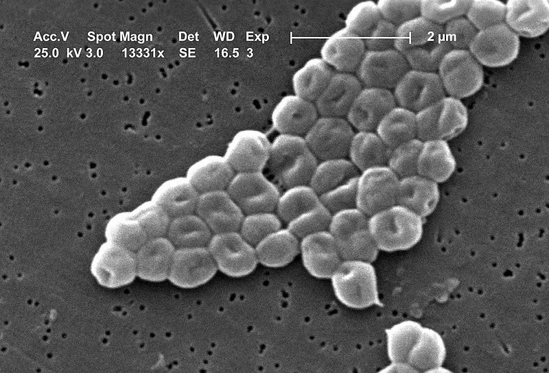 File:Acinetobacter baumannii.JPG