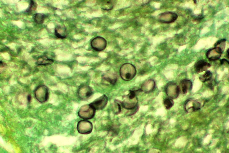 Файл:Pneumocystis carinii 01.jpg