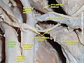 Internal carotid artery