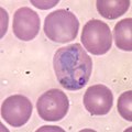 Plasmodium (Apicomplexa)