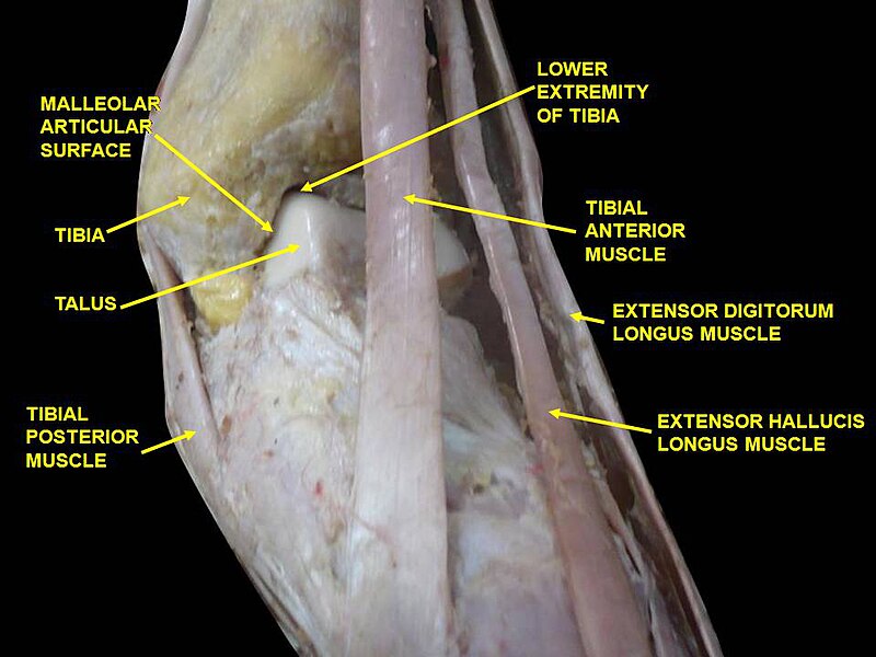 File:Slide3Bubu.JPG