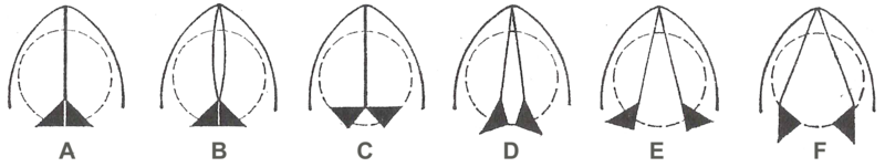 File:Glottis positions.png