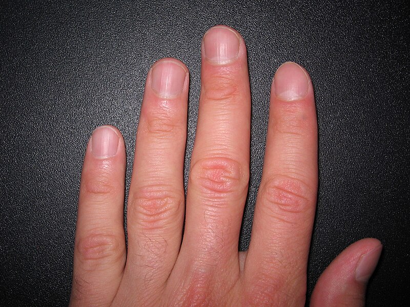 Файл:Fingernails1.JPG