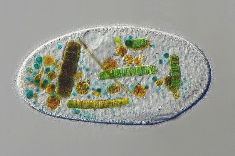 File:The ciliate Frontonia sp.jpg