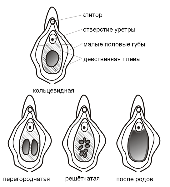 Файл:Tipy dewstwennych plew.png