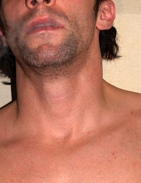 File:Neck by David Shankbone.jpg