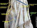 Extensor digiti minimi muscle