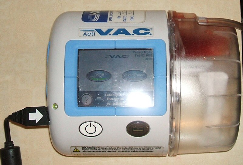 File:KCI Wound Vac02.jpg