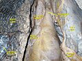 Visceral and parietal pleura.Deep dissection. Anterior view.