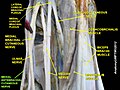 Medial antebrachial cutaneous nerve