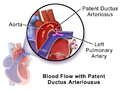 Illustration of PDA