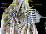 Flexor pollicis brevis muscle