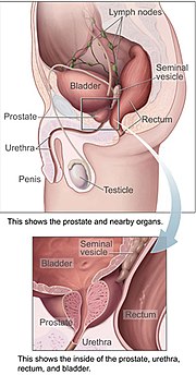 Thumbnail for Prostate