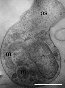 Amoeboaphelidium.jpg