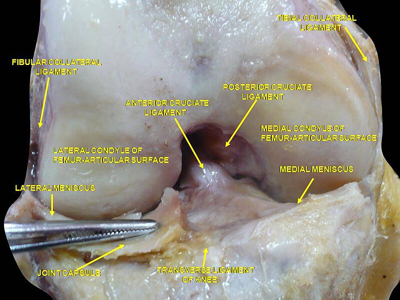 File:Slide2CAC.JPG