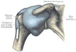 Thumbnail for Adhesive capsulitis of the shoulder