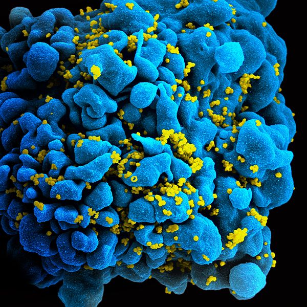 File:HIV-infected T cell (6813384933).jpg