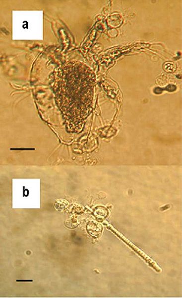 Файл:Batrachochytrium dendrobatidis.jpg