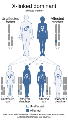 Этот синдром наследуется Х-сцепленным доминантным образом.