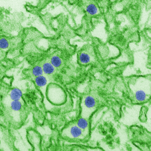 Electron micrograph of "Zika virus". Virus particles (digitally colored purple) are 40 nm in diameter, with an outer envelope and a dense inner core.