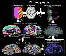 Process from MRI acquisition to whole brain structural network[26]