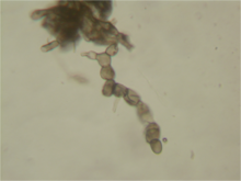 Monilia spores 160X.png