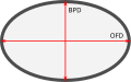 Cálculo del índice cefálico (CI) = diámetro biparietal (BPD) / diámetro occipitofrontal (OFD) x 100