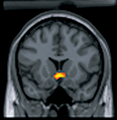 Ventral midbrain