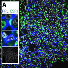 Prolactina Receptor-Estrog.png