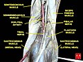 Popliteal artery