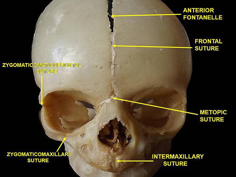 File:Slide1MIA.JPG