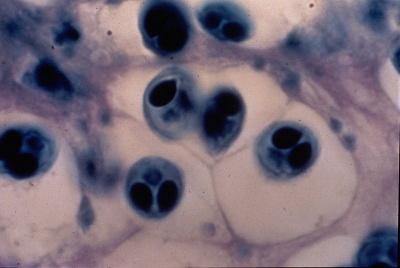 File:Whirling disease pathology.jpg