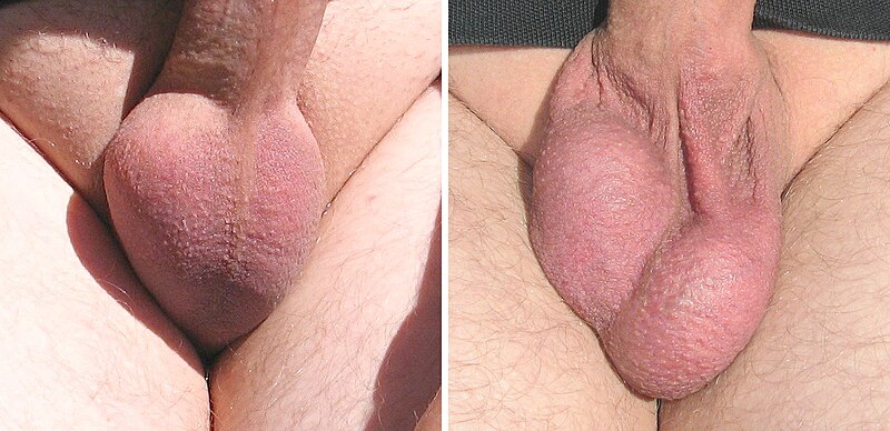 File:Scrotum.jpg