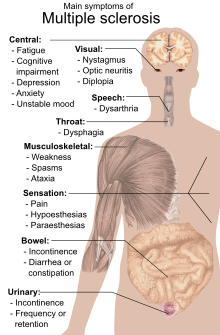 Symptoms of multiple sclerosis.svg