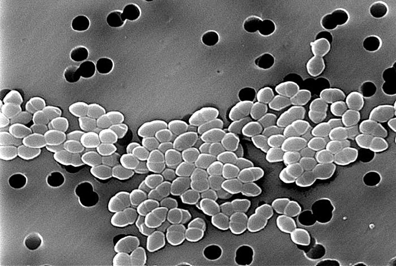 File:Vancomycin-Resistant Enterococcus 01.jpg