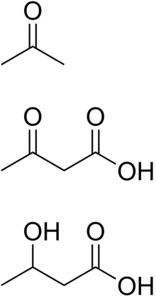 Ketone bodies.png